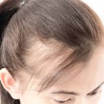 10 Tips Mencegah Kerontokan Rambut di Usia Muda
