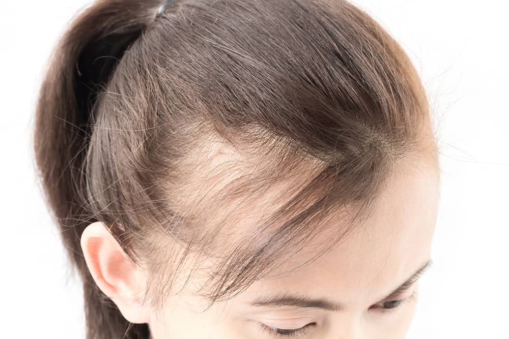 10 Tips Mencegah Kerontokan Rambut di Usia Muda