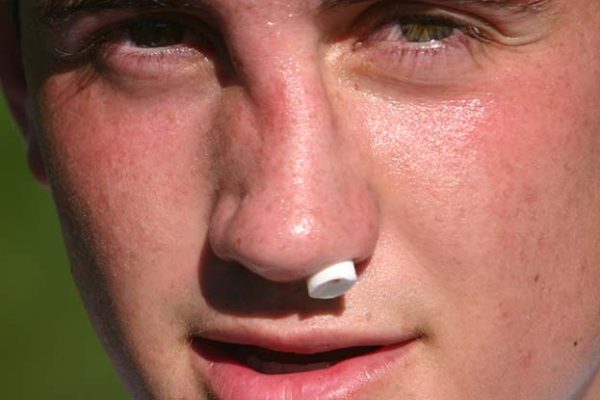 7 Cara Menangani Hidung Bengkak karena Cedera 7 Cara Menangani Hidung Bengkak karena Cedera