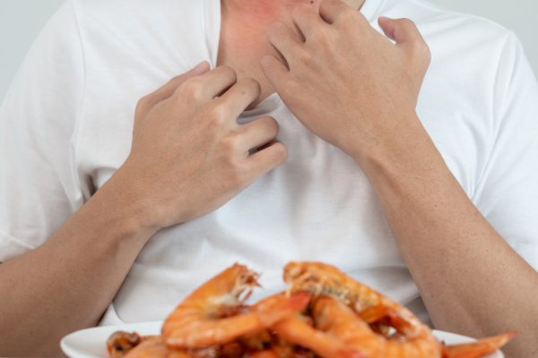 7 Langkah Aman Konsumsi Makanan untuk Alergi Seafood 7 Langkah Aman Konsumsi Makanan untuk Alergi Seafood