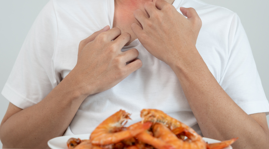 7 Langkah Aman Konsumsi Makanan untuk Alergi Seafood