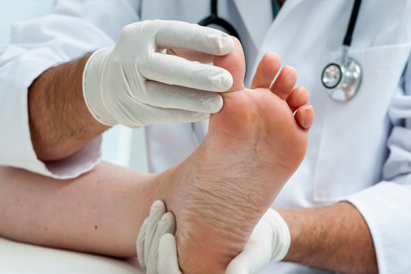 7 Tips Mengelola Kesehatan Kaki Diabetik Secara Efektif 7 Tips Mengelola Kesehatan Kaki Diabetik Secara Efektif