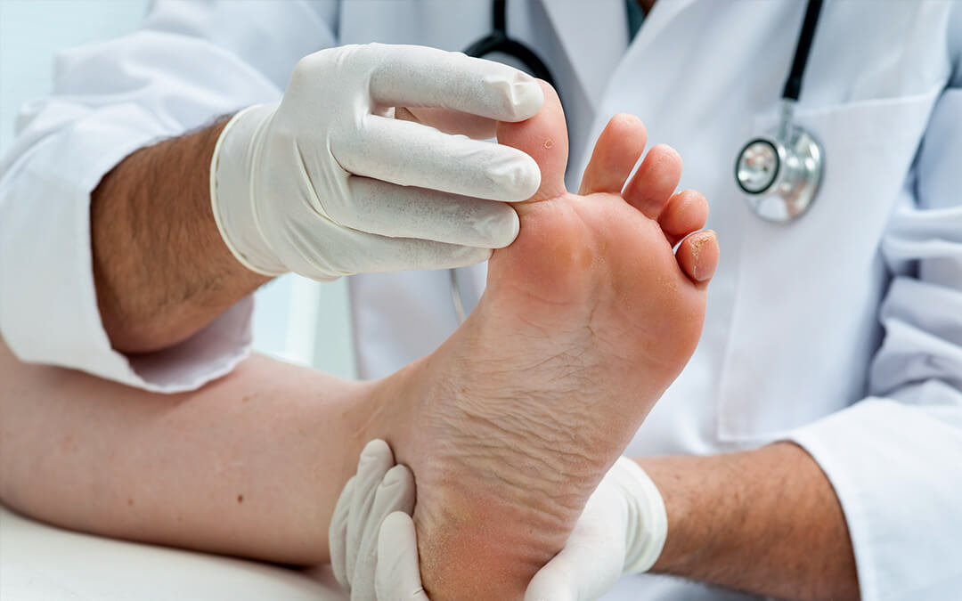 7 Tips Mengelola Kesehatan Kaki Diabetik Secara Efektif
